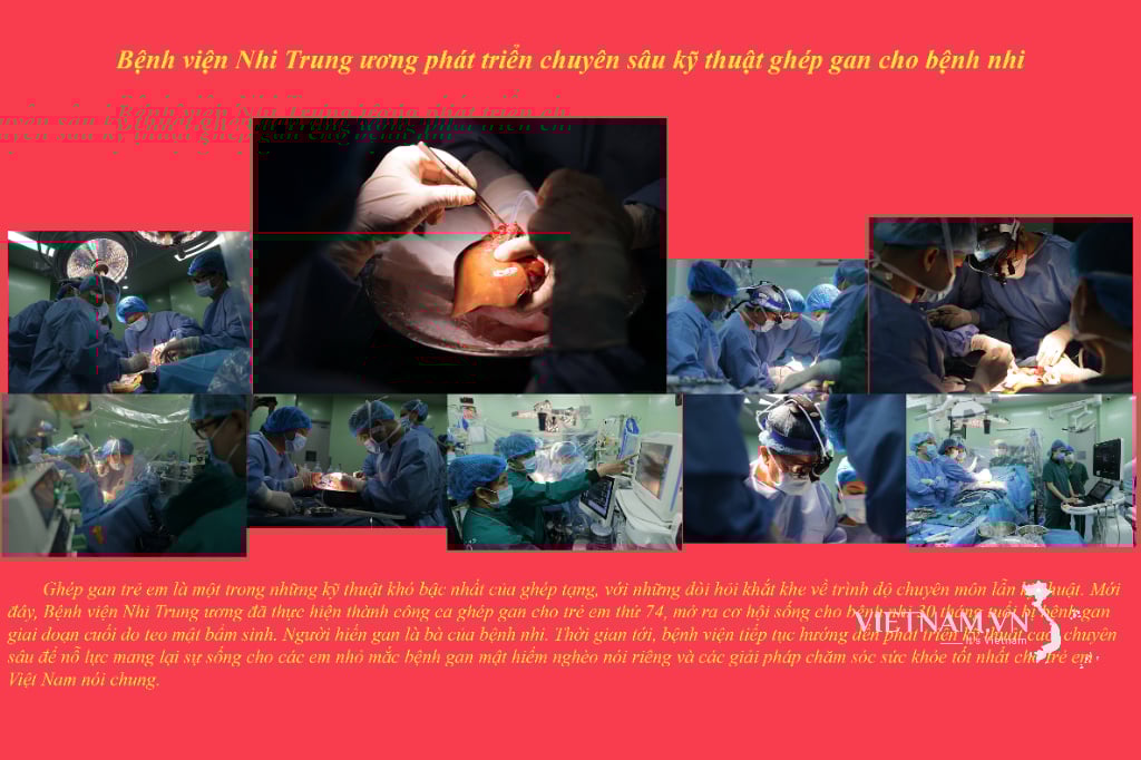 Bệnh viện Nhi Trung ương phát triển chuyên sâu kỹ thuật ghép gan cho bệnh nhi
