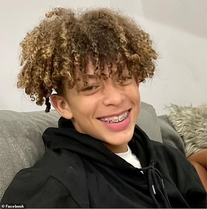 Beim Spielen einer TikTok-Challenge erleidet ein 16-jähriger Schüler Verbrennungen an 75 % seines Körpers – 2