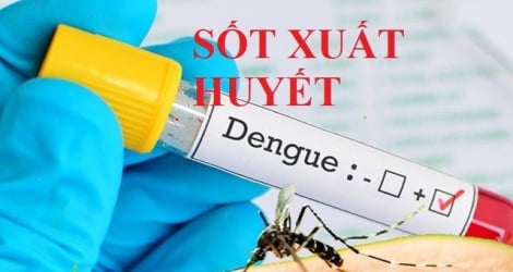 El CDC de Hanoi actualiza la situación del dengue, el sarampión y la meningitis