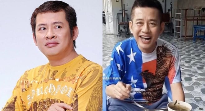 뇌졸중 후 아티스트 탄베오의 현재 건강 상태