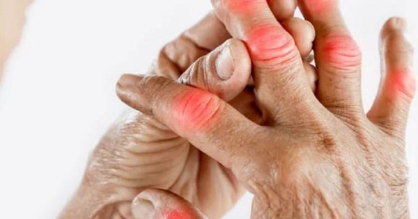 Les complications de l’arthrite sont-elles dangereuses ?