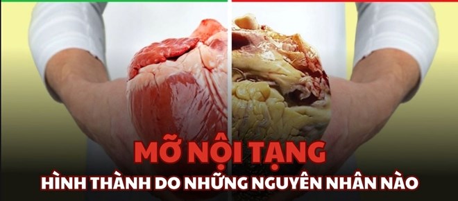 Mỡ nội tạng và nguyên nhân cốt lõi