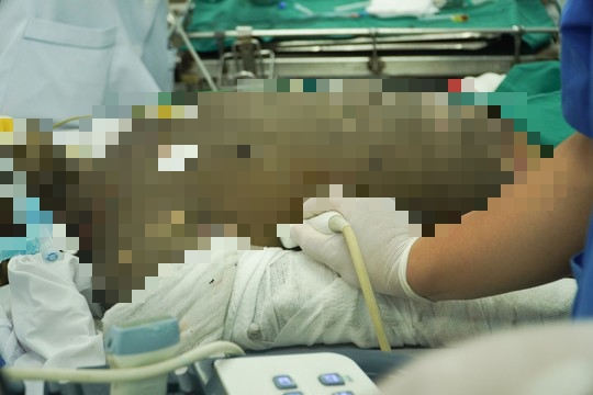 Bệnh viện Chợ Rẫy khẩn cấp cứu 3 nạn nhân trong vụ cháy lớn  - Ảnh 1.