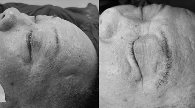 Der Tumor ist die Ursache, die Männer nicht in der Lage macht, das Bild zu ignorieren 1