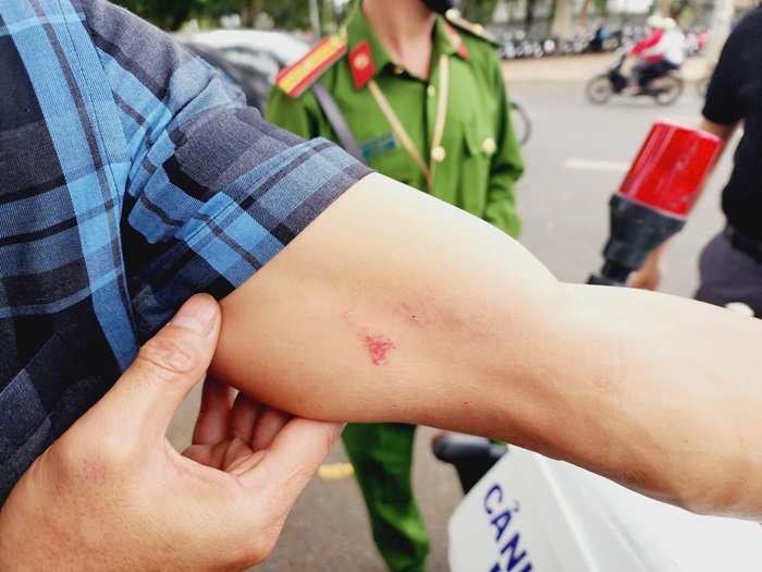 La police vérifie et clarifie le cas d'un journaliste de police agressé pendant qu'il travaillait. Photo 1