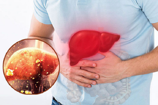 Signs that the liver is overloaded and needs detoxification.