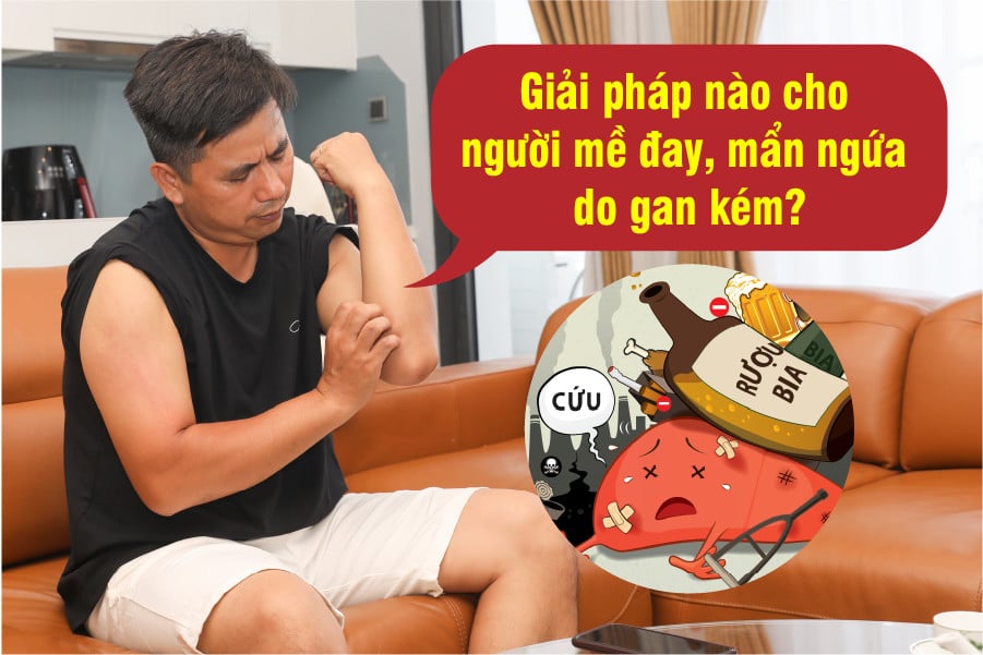 Mẩn ngứa do gan – Hiểu đúng để điều trị hiệu quả