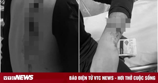 Hanoi male student chased and slashed by a group of teenagers with weapons in the middle of the street