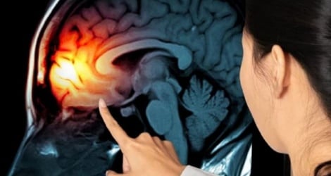 Pensó que era depresión posparto, fue al médico y descubrió que tenía un tumor cerebral.