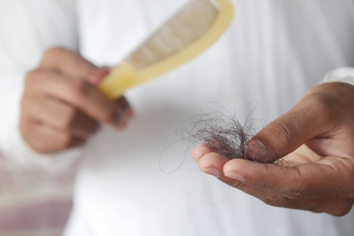 6 Gründe, warum Haare leicht ausfallen