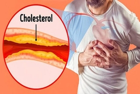 7 tipos de bebidas que reducen el colesterol, buenas para personas con niveles altos de grasa en la sangre