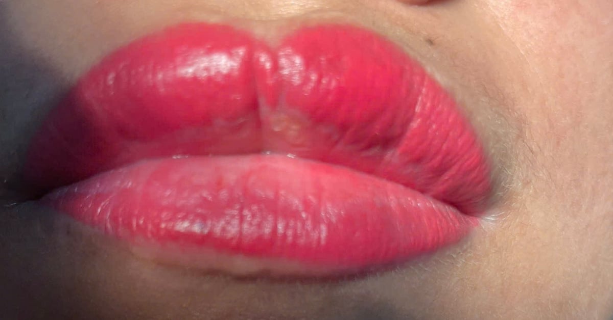 Girl gets lip tattoo for Tet, panics and seeks doctor because it turns into 'catfish lips'