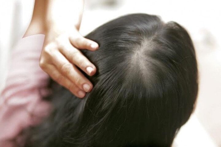 En la mediana edad, el cabello será propenso a romperse y caerse.