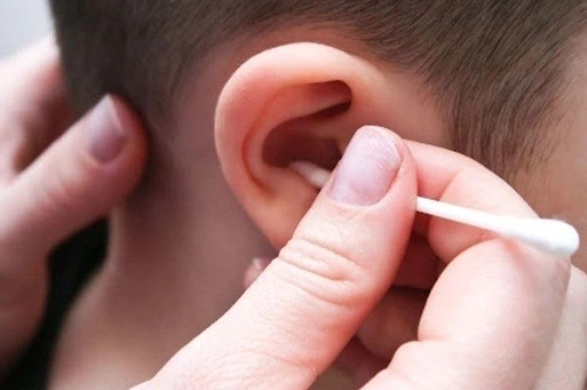 Có nên lấy ráy tai thường xuyên cho trẻ?- Ảnh 1.