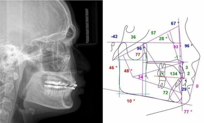 El médico analiza los datos de rayos X del cliente. Foto: Elite Dental