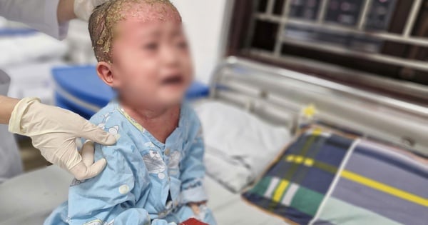 2-year-old boy has ulcers and fluid all over his body because his parents did this on their own