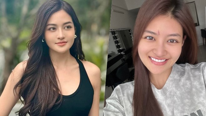 女優トゥイ・アンが撮影中に事故に遭い、6針縫うことになった