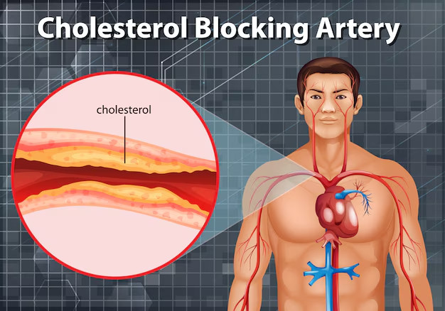 cholesterol