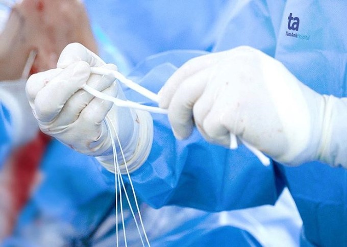 The artificial ligament is made from a combination of about 3,000 polyethylene fibers. Photo: Tam Anh General Hospital