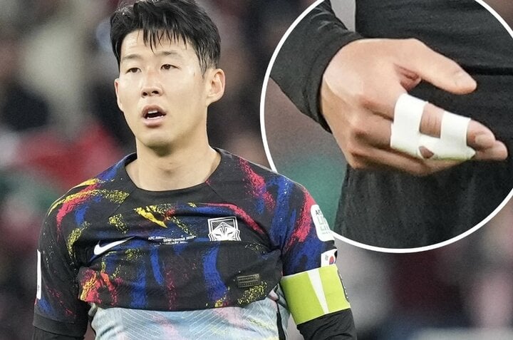 La main de Son a été blessée à son retour à Tottenham.