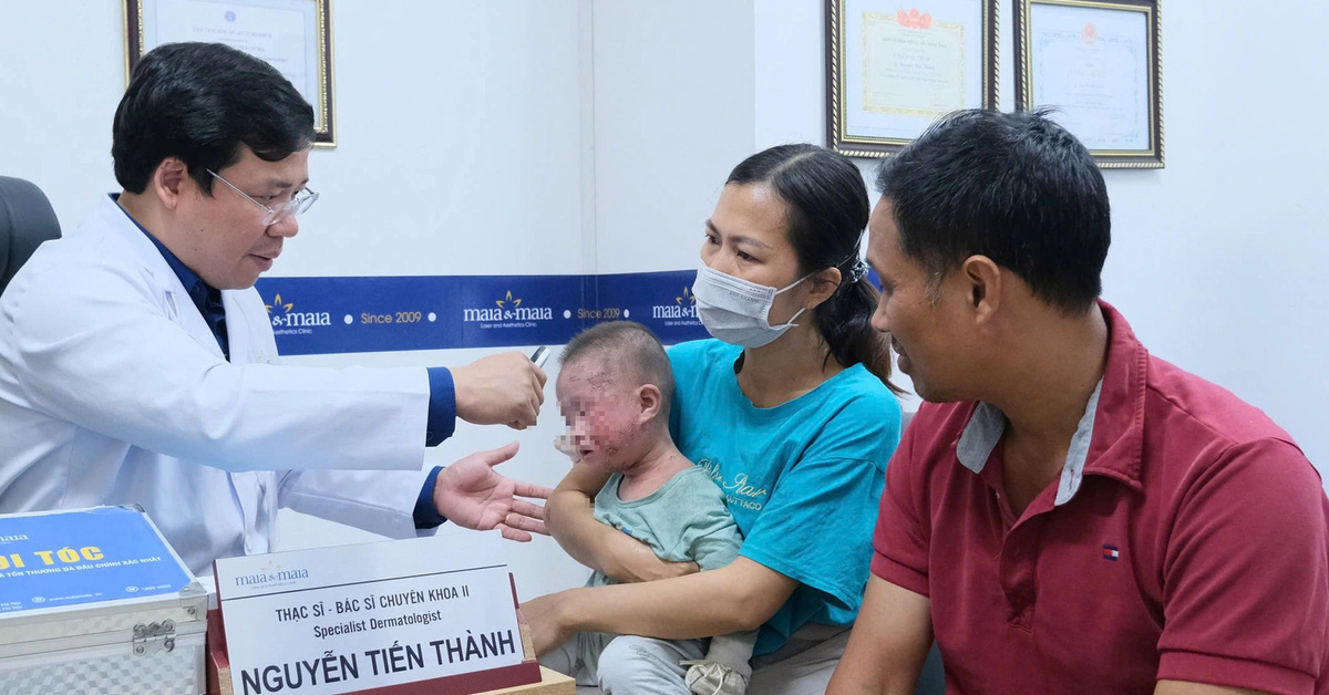 1 year old boy has blisters all over his face, oozing fluid due to atopic dermatitis