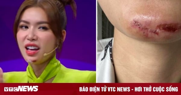 Le mannequin Minh Tu a été frappé au visage par une flycam et a eu besoin de plus de 10 points de suture.