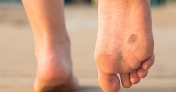 6 changes on the feet that seem normal are signs of cancer that few people know about