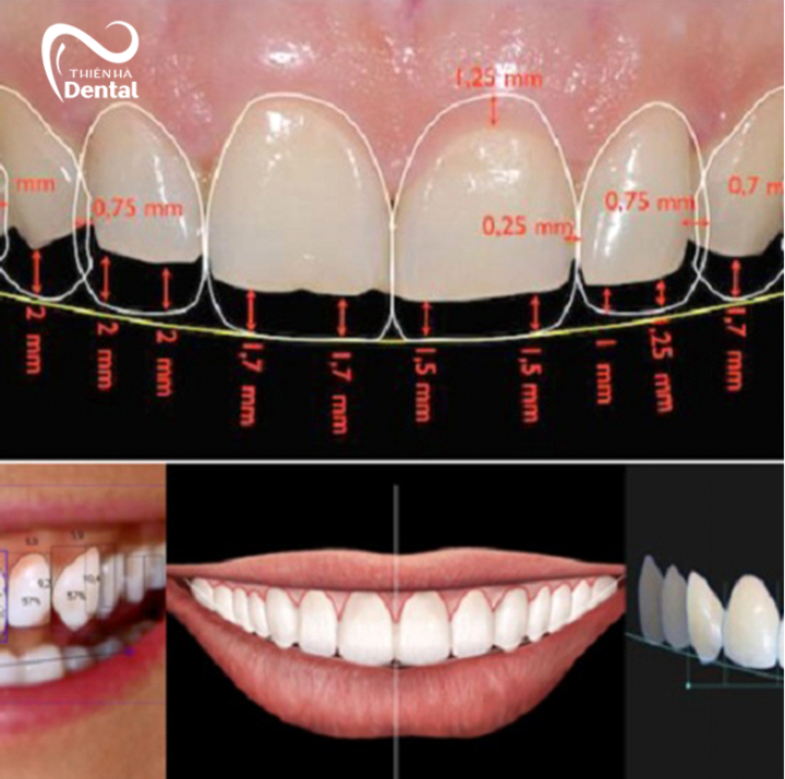 สัมผัสประสบการณ์รอยยิ้มใหม่ของคุณก่อนที่จะทำ