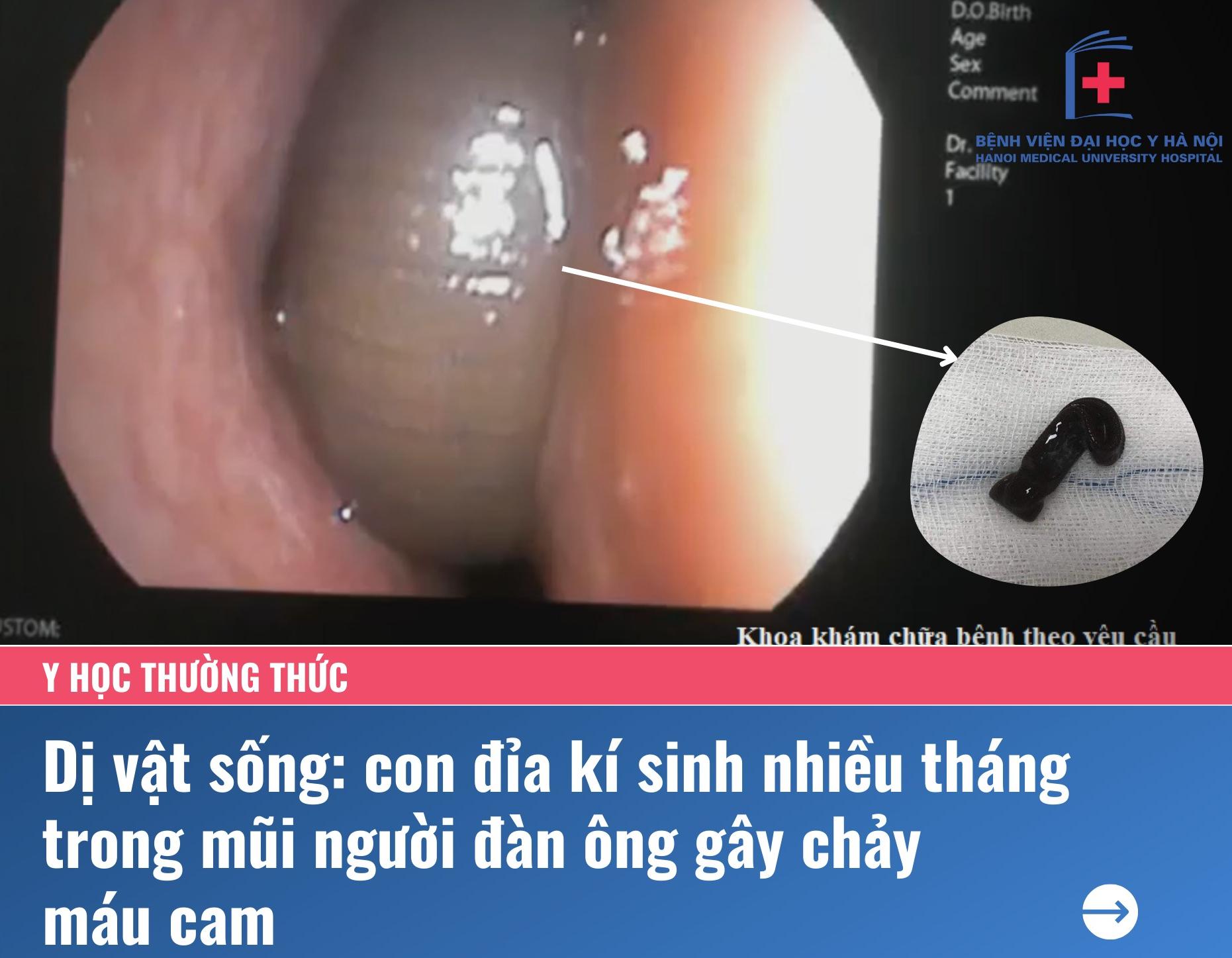 3ヶ月以上鼻水が続いており、副鼻腔炎と診断され、抗生物質を服用しました。写真1