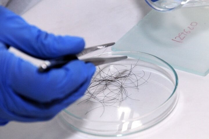 If you want to test DNA, you only need 10 hairs with roots, or fingernails or blood samples. (Illustration photo)