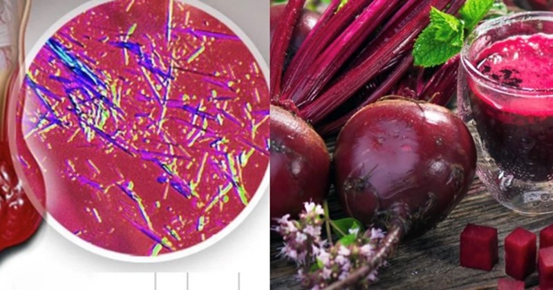 Beets can help eliminate uric acid effectively