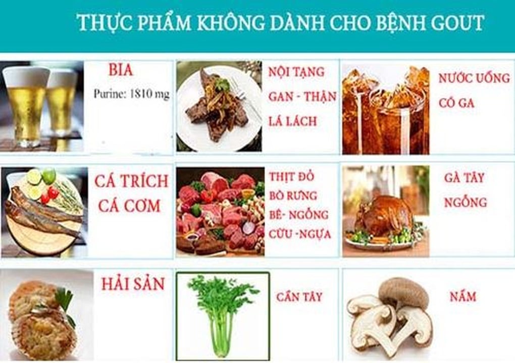 Ngày Tết, người mắc bệnh gút cần ăn ít những thực phẩm này - 1