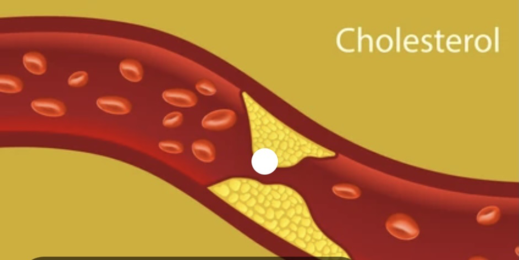 Khoa học chỉ ra loại trái "vàng" độc đáo giúp giảm mức cholesterol cao - Ảnh 1.