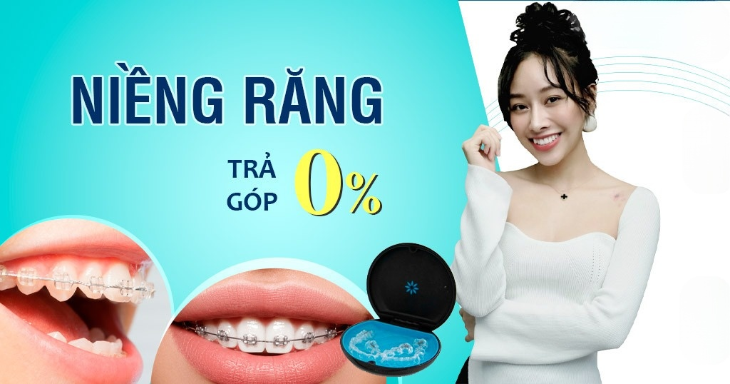 교정 치료를 받기에 가장 좋은 곳은 어디일까요? 평판이 좋은 최고의 치과 교정 클리닉을 추천해 주세요.