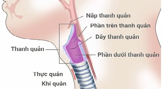 Diễn viên Hồng Ánh gặp vấn đề nghiêm trọng về sức khỏe, căn bệnh của cô nguy hiểm thế nào? - Ảnh 3.