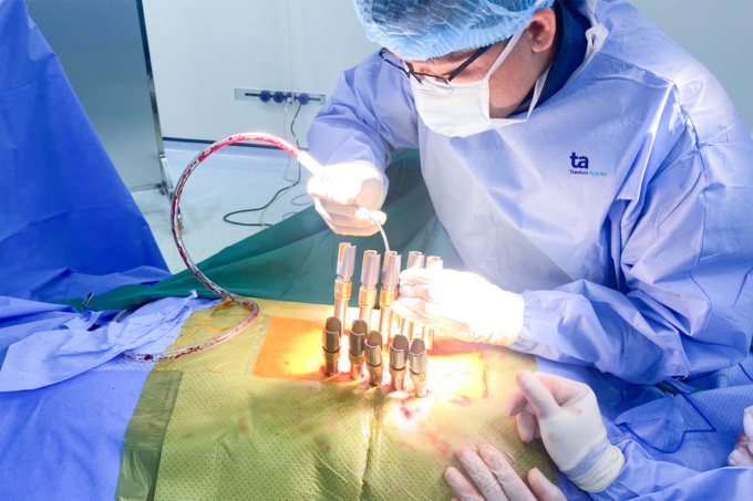 Le docteur Thanh Tri lors d'une intervention chirurgicale pour traiter une neuropathie spinale. Photo : Hôpital général de Tam Anh