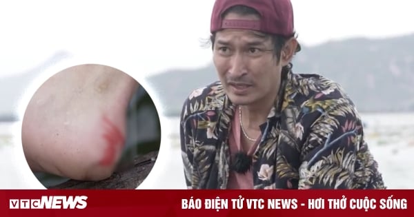 Huy Khanh was injured while catching seafood to earn money.