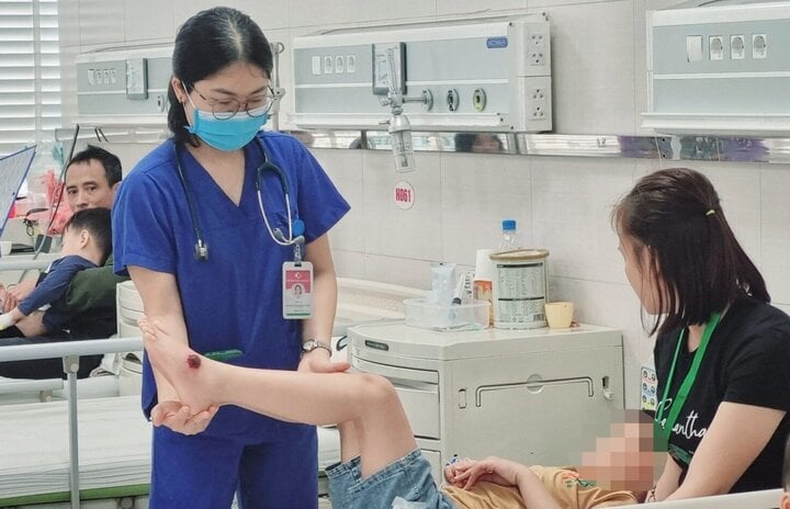 El médico examina y evalúa la movilidad del niño antes del alta. (Foto: BVCC)