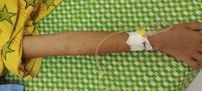 Image of a child's arm covered with razor blade incisions. Photo: Provided by the hospital