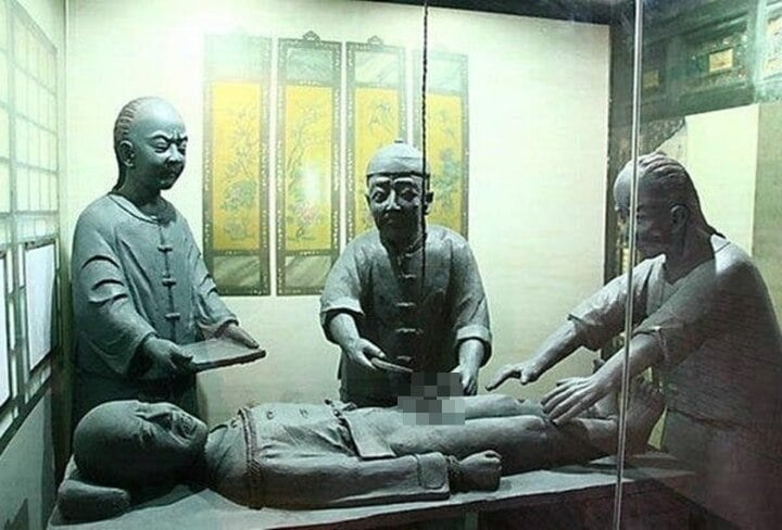 中国の歴史における宦官の苦痛を伴う去勢プロセス - 1