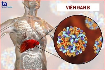 Bác sĩ của bạn: Không tự ý bỏ thuốc điều trị viêm gan B