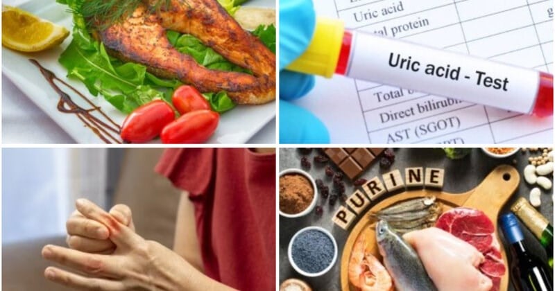 4 foods that increase uric acid