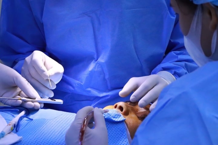 Complications à connaître lors de la réalisation d'une rhinoplastie structurelle utilisant du cartilage costal et du cartilage de l'oreille - 3