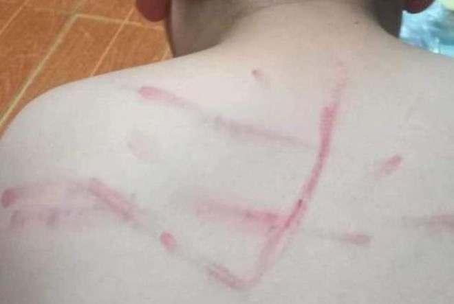 Violencia escolar por parte de los docentes, una cara sucia es un mal ejemplo