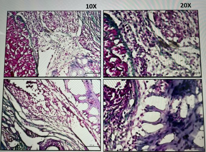 TB2 サンプルにおける幹細胞シートと心筋の接続の拡大画像。写真: NVCC