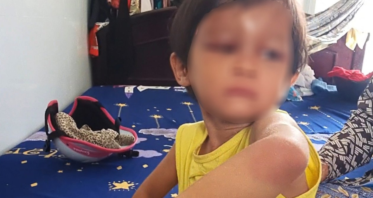 Adoptive father arrested for abusing 4-year-old girl in Ca Mau