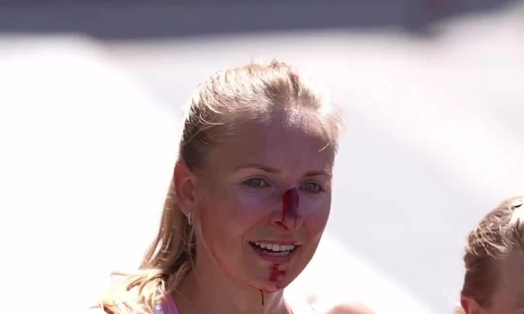 Nordskar finished with a bloody face