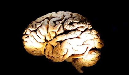 Hy vọng mới về phương pháp điều trị cho các bệnh nhân Alzheimer