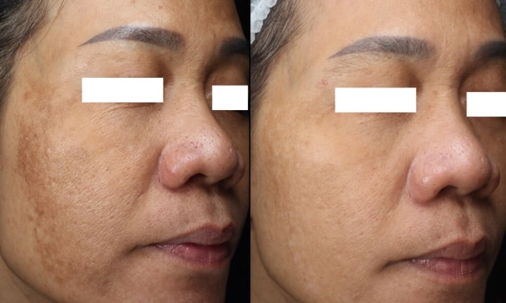 Phòng khám chuyên khoa da liễu DRH Clinic và 7 năm 'giải cứu' làn da biến chứng - 3