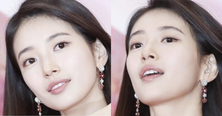 Suzy បាន​វះកាត់​យក​ប្រជ្រុយ​នៅ​ភ្នែក​ចេញ។